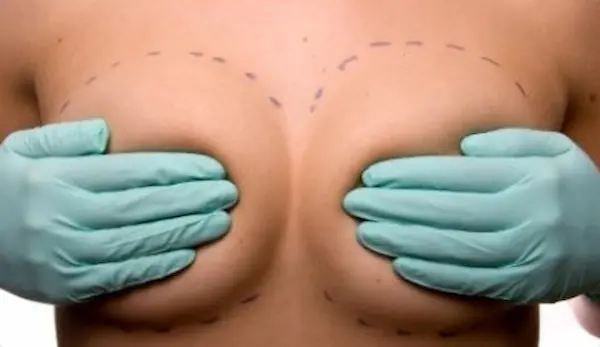 Breast Implants and reductions Medical Tourism in Phuket