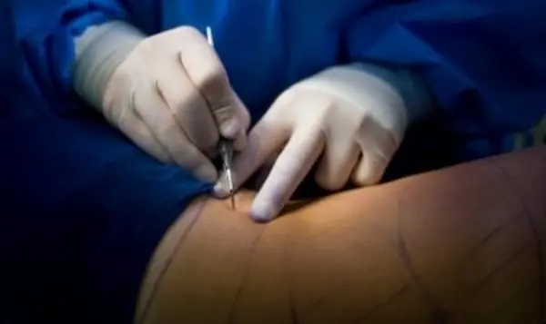 Medical Tourism in Phuket Medical procedures in Phuket